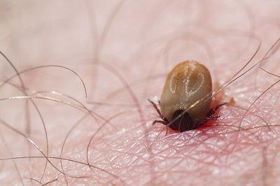 Removing a tick by Anteater Exterminating Inc. Removing a tick